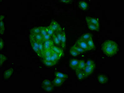 Immunofluorescence staining of HepG2 cells with KIF20B Antibody at 1:133, counter-stained with DAPI. The cells were fixed in 4% formaldehyde, permeabilized using 0.2% Triton X-100 and blocked in 10% normal Goat Serum. The cells were then incubated with the antibody overnight at 4°C. The secondary antibody was Alexa Fluor 488-congugated AffiniPure Goat Anti-Rabbit IgG(H+L).
