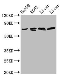 Western Blot  | Positive WB detected in: HepG2 whole cell lysate, K562 whole cell lysate, Rat liver tissue, Mouse liver tissue  | All lanes: PANX2 antibody at 4.2µg/ml  | Secondary  | Goat polyclonal to rabbit IgG at 1/50000 dilution  | Predicted band size: 75, 71, 56 kDa  | Observed band size: 75 kDaRabbit anti-Human PANX2 Polyclonal Antibody