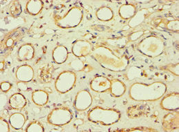 Immunohistochemistry of paraffin-embedded human kidney tissue using BBS4 Antibody at dilution of 1:100