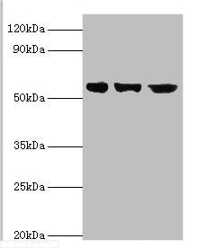 Western blot | All lanes: Bardet-Biedl syndrome 4 protein antibody at 4μg/ml | Lane 1: Hela whole cell lysate | Lane 2: U251 whole cell lysate | Lane 2: Mouse heart tissue | Secondary | Goat polyclonal to rabbit IgG at 1/10000 dilution | Predicted band size: 59, 60, 39 kDa | Observed band size: 59 kDa