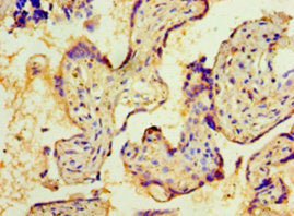 Immunohistochemistry of paraffin-embedded human placenta tissue using NMNAT3 Antibody at dilution of 1:100Rabbit anti-Human NMNAT3 Polyclonal Antibody