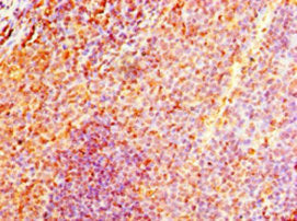 Immunohistochemistry of paraffin-embedded human tonsil tissue using NMNAT3 Antibody at dilution of 1:100Rabbit anti-Human NMNAT3 Polyclonal Antibody