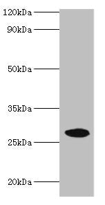 Western blot  | All lanes: NMNAT3 antibody at 2µg/ml + Mouse brain tissue  | Secondary  | Goat polyclonal to rabbit IgG at 1/10000 dilution  | Predicted band size: 29, 25, 19 kDa  | Observed band size: 29 kDaRabbit anti-Human NMNAT3 Polyclonal Antibody