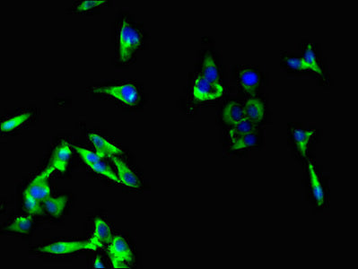 Immunofluorescent analysis of Hela cells using RPTOR Antibody at dilution of 1:100 and Alexa Fluor 488-congugated AffiniPure Goat Anti-Rabbit IgG(H+L)Rabbit anti-Human RPTOR Polyclonal Antibody