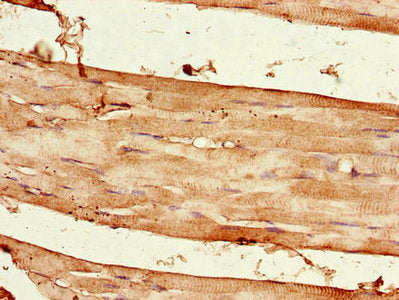 Immunohistochemistry of paraffin-embedded human skeletal muscle tissue using the antibody at dilution of 1:100Rabbit anti-Human RPTOR Polyclonal Antibody