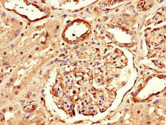 Immunohistochemistry of paraffin-embedded human kidney tissue using RPTOR Antibody at dilution of 1:100Rabbit anti-Human RPTOR Polyclonal Antibody