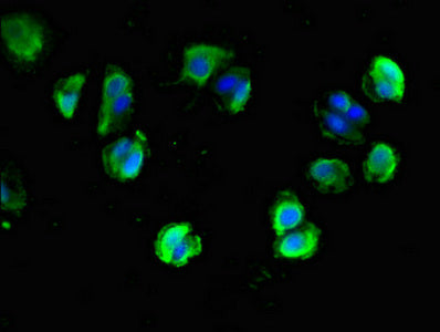 Immunofluorescent analysis of MCF-7 cells using NLGN1 Antibody at dilution of 1:100 and Alexa Fluor 488-congugated AffiniPure Goat Anti-Rabbit IgG(H+L)Rabbit anti-Human NLGN1 Polyclonal Antibody