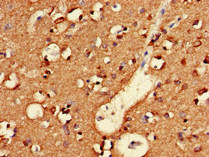 Immunohistochemistry of paraffin-embedded human brain tissue using the antibody at dilution of 1:100Rabbit anti-Human NLGN1 Polyclonal Antibody