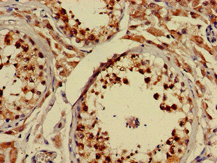 Immunohistochemistry of paraffin-embedded human testis tissue using NLGN1 Antibody at dilution of 1:100Rabbit anti-Human NLGN1 Polyclonal Antibody