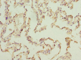 Immunohistochemistry of paraffin-embedded human lung tissue using ELMOD1 Antibody at dilution of 1:100Rabbit anti-Human ELMOD1 Polyclonal Antibody
