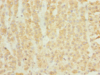 Immunohistochemistry of paraffin-embedded human adrenal gland tissue using ELMOD1 Antibody at dilution of 1:100Rabbit anti-Human ELMOD1 Polyclonal Antibody