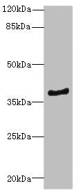 Western blot | All lanes: ELMOD1antibody at 0.7μg/ml + Mouse kidney tissue | Secondary | Goat polyclonal to rabbit IgG at 1/10000 dilution | Predicted band size: 40, 23, 39 kDa | Observed band size: 40 kDaRabbit anti-Human ELMOD1 Polyclonal Antibody