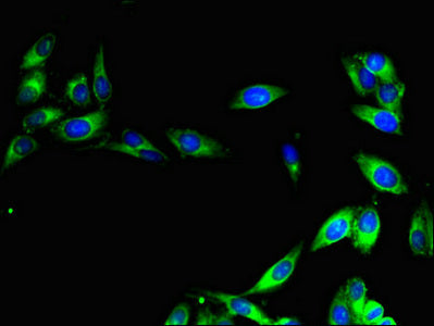 Immunofluorescent analysis of Hela cells using CISD2 Antibody at dilution of 1:100 and Alexa Fluor 488-congugated AffiniPure Goat Anti-Rabbit IgG(H+L)Rabbit anti-Human CISD2 Polyclonal Antibody