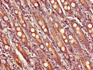 Immunohistochemistry of paraffin-embedded human small intestine tissue using USHBP1 Antibody at dilution of 1:100