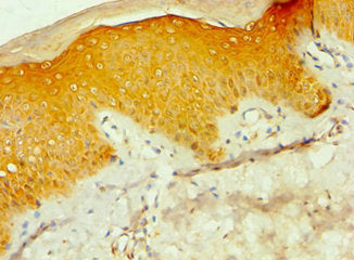 Immunohistochemistry of paraffin-embedded human skin tissue using CSNK1A1L Antibody at dilution of 1:100Rabbit anti-Human CSNK1A1L Polyclonal Antibody