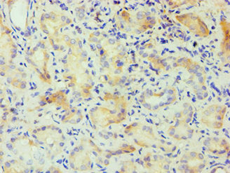 Immunohistochemistry of paraffin-embedded human kidney tissue using CSNK1A1L Antibody at dilution of 1:100Rabbit anti-Human CSNK1A1L Polyclonal Antibody