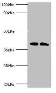Western blot | All lanes: Casein kinase I isoform alpha-like antibody at 4μg/ml | Lane 1: K562 whole cell lysate | Lane 2: Hela whole cell lysate | Secondary | Goat polyclonal to rabbit IgG at 1/10000 dilution | Predicted band size: 39 kDa | Observed band size: 39 kDaRabbit anti-Human CSNK1A1L Polyclonal Antibody