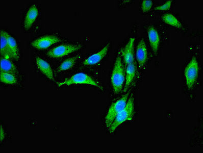 Immunofluorescent analysis of Hela cells using MCPH1 Antibody at dilution of 1:100 and Alexa Fluor 488-congugated AffiniPure Goat Anti-Rabbit IgG(H+L)