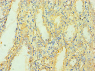 Immunohistochemistry of paraffin-embedded human kidney tissue using MCPH1 Antibody at dilution of 1:100
