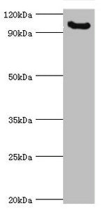 Western blot | All lanes: Microcephalin antibody at 3μg/ml + Mouse liver tissue | Secondary | Goat polyclonal to rabbit IgG at 1/10000 dilution | Predicted band size: 93, 63, 68 kDa | Observed band size: 93 kDa