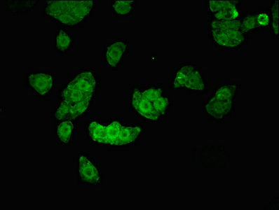 Immunofluorescent analysis of PC-3 cells using UHMK1 Antibody at dilution of 1:100 and Alexa Fluor 488-congugated AffiniPure Goat Anti-Rabbit IgG(H+L)Rabbit anti-Human UHMK1 Polyclonal Antibody