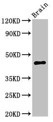 Western Blot | Positive WB detected in: Mouse brain tissue | All lanes: UHMK1 antibody at 3μg/ml | Secondary | Goat polyclonal to rabbit IgG at 1/50000 dilution | Predicted band size: 47, 39, 40 kDa | Observed band size: 47 kDaRabbit anti-Human UHMK1 Polyclonal Antibody