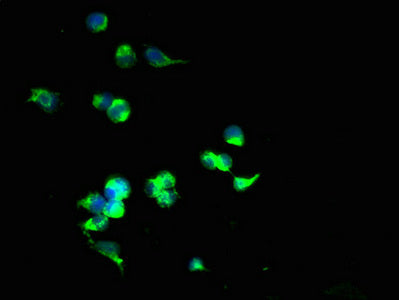 Immunofluorescent analysis of 293T cells using the antibody at dilution of 1:100 and Alexa Fluor 488-congugated AffiniPure Goat Anti-Rabbit IgG(H+L)Rabbit anti-Human SLC25A40 Polyclonal Antibody