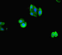 Immunofluorescent analysis of HepG2 cells using ACTL9 Antibody at dilution of 1:100 and Alexa Fluor 488-congugated AffiniPure Goat Anti-Rabbit IgG(H+L)