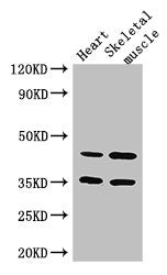 Western Blot | Positive WB detected in: Mouse heart tissue, Mouse skeletal muscle tissue | All lanes: ACTL9 antibody at 3.25μg/ml | Secondary | Goat polyclonal to rabbit IgG at 1/50000 dilution | Predicted band size: 46 kDa | Observed band size: 46, 35 kDa