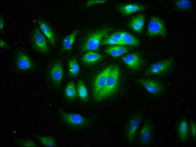 Immunofluorescence staining of A549 cells with CD99L2 Antibody at 1:133, counter-stained with DAPI. The cells were fixed in 4% formaldehyde, permeabilized using 0.2% Triton X-100 and blocked in 10% normal Goat Serum. The cells were then incubated with the antibody overnight at 4°C. The secondary antibody was Alexa Fluor 488-congugated AffiniPure Goat Anti-Rabbit IgG(H+L).Rabbit anti-Human CD99L2 Polyclonal Antibody
