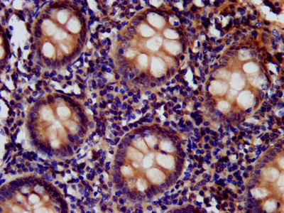 IHC image of CD99L2 Antibody diluted at 1:400 and staining in paraffin-embedded human appendix tissue performed on a Leica BondTM system.Rabbit anti-Human CD99L2 Polyclonal Antibody