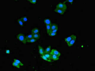 Immunofluorescent analysis of HepG2 cells using USP33 Antibody at dilution of 1:100 and Alexa Fluor 488-congugated AffiniPure Goat Anti-Rabbit IgG(H+L)Rabbit anti-Human USP33 Polyclonal Antibody