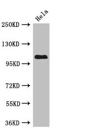 Western Blot  | Positive WB detected in: Hela whole cell lysate  | All lanes: USP33 antibody at 3µg/ml  | Secondary  | Goat polyclonal to rabbit IgG at 1/50000 dilution  | Predicted band size: 107, 104, 94 kDa  | Observed band size: 107 kDaRabbit anti-Human USP33 Polyclonal Antibody