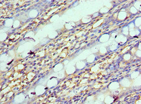 Immunohistochemistry of paraffin-embedded human colon tissue using NPRL2 Antibody at dilution of 1:100Rabbit anti-Human NPRL2 Polyclonal Antibody