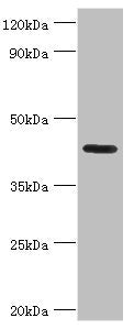 Western blot | All lanes: Nitrogen permease regulator 2-like protein antibody at 7μg/ml + Mouse skeletal muscle tissue | Secondary | Goat polyclonal to rabbit IgG at 1/10000 dilution | Predicted band size: 44, 24 kDa | Observed band size: 44 kDaRabbit anti-Human NPRL2 Polyclonal Antibody