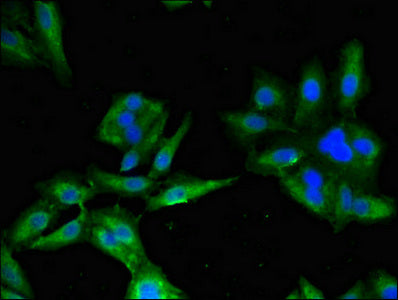 Immunofluorescent analysis of Hela cells using BLNK Antibody at dilution of 1:100 and Alexa Fluor 488-congugated AffiniPure Goat Anti-Rabbit IgG(H+L)