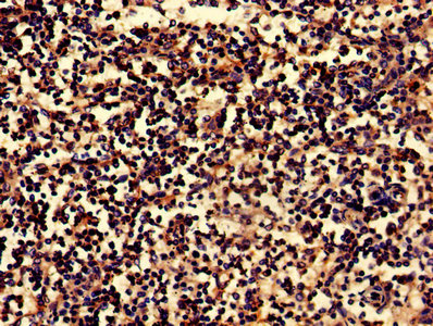 IHC image of BLNK Antibody diluted at 1:800 and staining in paraffin-embedded human spleen tissue performed on a Leica BondTM system. After dewaxing and hydration, antigen retrieval was mediated by high pressure in a citrate buffer (pH 6.0). Section was blocked with 10% normal goat serum 30min at RT. Then primary antibody (1% BSA) was incubated at 4°C overnight. The primary is detected by a biotinylated secondary antibody and visualized using an HRP conjugated SP system.