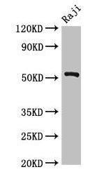 Western Blot  | Positive WB detected in: Raji whole cell lysate  | All lanes: BLNK antibody at 2.7µg/ml  | Secondary  | Goat polyclonal to rabbit IgG at 1/50000 dilution  | Predicted band size: 51, 49, 45 kDa  | Observed band size: 51 kDa