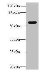 Western blot  | All lanes: SLC35F5 antibody at 6µg/ml + Hela whole cell lysate  | Secondary  | Goat polyclonal to rabbit IgG at 1/10000 dilution  | Predicted band size: 59, 28 kDa  | Observed band size: 59 kDaRabbit anti-Human SLC35F5 Polyclonal Antibody