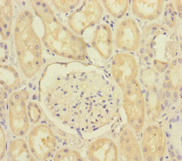 Immunohistochemistry of paraffin-embedded human kidney tissue using SCFD1 Antibody at dilution of 1:100Rabbit anti-Human SCFD1 Polyclonal Antibody