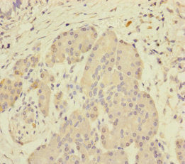 Immunohistochemistry of paraffin-embedded human pancreatic tissue using SCFD1 Antibody at dilution of 1:100Rabbit anti-Human SCFD1 Polyclonal Antibody