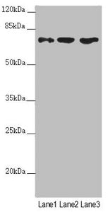 Western blot  | All lanes: SCFD1 antibody at 4.48µg/ml  | Lane 1: Mouse liver tissue  | Lane 2: Hela whole cell lysate  | Lane 3: A549 whole cell lysate  | Secondary  | Goat polyclonal to rabbit IgG at 1/10000 dilution  | Predicted band size: 73, 63, 66 kDa  | Observed band size: 73 kDaRabbit anti-Human SCFD1 Polyclonal Antibody