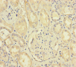 Immunohistochemistry of paraffin-embedded human kidney tissue using SCFD1 Antibody at dilution of 1:100Rabbit anti-Human SCFD1 Polyclonal Antibody