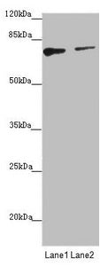 Western blot  | All lanes: SCFD1 antibody at 2.92µg/ml  | Lane 1: Hela whole cell lysate  | Lane 2: A549 whole cell lysate  | Secondary  | Goat polyclonal to rabbit IgG at 1/10000 dilution  | Predicted band size: 73, 63, 66 kDa  | Observed band size: 73 kDaRabbit anti-Human SCFD1 Polyclonal Antibody