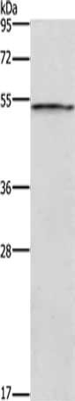 Gel: 8%SDS-PAGE, Lysate: 40 μg, Lane: Mouse skeletal muscle tissue , Primary antibody: SMAD1 Antibody(SMAD1 Antibody) at dilution 1/800, Secondary antibody: Goat anti rabbit IgG at 1/8000 dilution, Exposure time: 3 minutesRabbit anti-Human SMAD1 Polyclonal Antibody