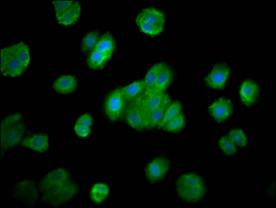 Immunofluorescence staining of HepG2 cells with SMG7 Antibody at 1:200, counter-stained with DAPI. The cells were fixed in 4% formaldehyde, permeabilized using 0.2% Triton X-100 and blocked in 10% normal Goat Serum. The cells were then incubated with the antibody overnight at 4°C. The secondary antibody was Alexa Fluor 488-congugated AffiniPure Goat Anti-Rabbit IgG(H+L).Rabbit anti-Human SMG7 Polyclonal Antibody