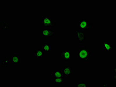 Immunofluorescence staining of MCF-7 cells with TFAP2C Antibody at 1:100, counter-stained with DAPI. The cells were fixed in 4% formaldehyde, permeabilized using 0.2% Triton X-100 and blocked in 10% normal Goat Serum. The cells were then incubated with the antibody overnight at 4°C. The secondary antibody was Alexa Fluor 488-congugated AffiniPure Goat Anti-Rabbit IgG(H+L).Rabbit anti-Human TFAP2C Polyclonal Antibody