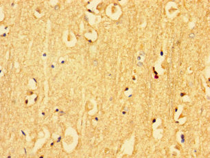 Immunohistochemistry of paraffin-embedded human brain tissue using KLK6 Antibody at dilution of 1:100