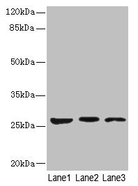 Western blot  | All lanes: KLK6 antibody at 5µg/ml  | Lane 1: Mouse liver tissue  | Lane 2: Mouse brain tissue  | Lane 3: A375 whole cell lysate  | Secondary  | Goat polyclonal to rabbit IgG at 1/10000 dilution  | Predicted band size: 27, 16, 5 kDa  | Observed band size: 27 kDa