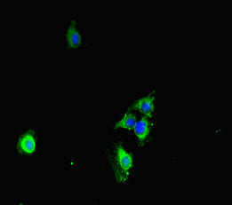 Immunofluorescent analysis of Hela cells using CDS1 Antibody at dilution of 1:100 and Alexa Fluor 488-congugated AffiniPure Goat Anti-Rabbit IgG(H+L)Rabbit anti-Human CDS1 Polyclonal Antibody